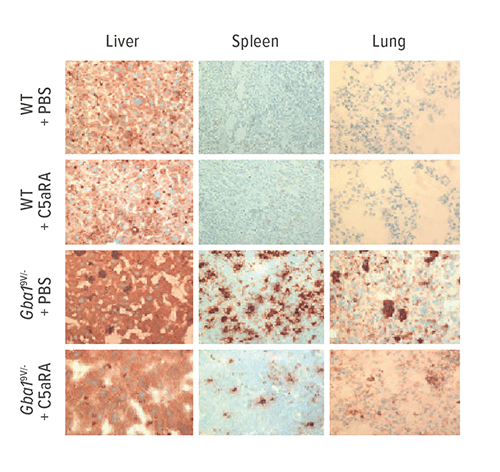 These tissue samples from mouse models of Gaucher disease show that C5aR-targeting provides significant reductions in glucosylceramide accumulation and inflammation.